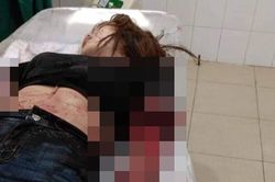 Chém đứt lìa 2 cánh tay vợ do bị người tình của vợ khiêu khích, kích động?