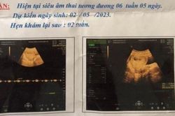 Nữ sinh lớp 6 ở Nghệ An nghi bị bảo vệ trường học xâm hại đến có thai