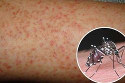 Cách chăm sóc và dùng thuốc khi mắc sốt xuất huyết tại nhà