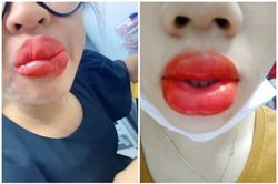 Những màn xăm môi khiến chị em không dám soi gương