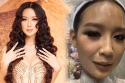 Sát ngày lên đường thi đấu, Á hậu Bảo Ngọc để lộ gương mặt với làn da 'bất ổn'