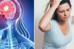 Cô gái 19 tuổi đột quỵ não sau cơn đau đầu đột ngột, chuyên gia khuyến cáo giới trẻ cần biết điều này để phòng bệnh cho chính mình