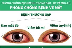Phòng chống bệnh về mắt trong mùa bão lụt và mưa lũ