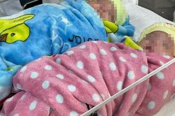 Kỳ diệu: Lần đầu tiên tại Việt Nam nuôi sống thành công cặp song sinh nặng 500g, chào đời ở tuần thai thứ 25