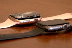 Người dùng nhập viện vì Apple Watch phát nổ