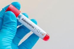 Khi nào nên xét nghiệm Adenovirus cho trẻ?