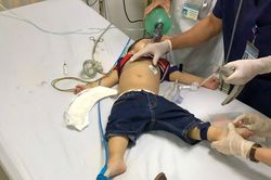 Cứu bé trai 22 tháng tuổi bị ngưng tim do hóc rau câu