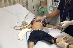 Cứu sống bé trai 22 tháng tuổi ngưng tim, ngưng thở do hóc thạch rau câu