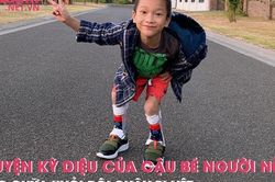Câu chuyện kỳ diệu của cậu bé người Nùng được chữa khỏi đôi chân bị liệt
