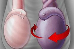 Cảnh giác sau cơn đau tức lúc ngủ, nam sinh may mắn giữ được khả năng đàn ông