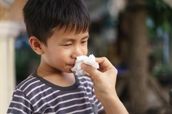 Nguyên nhân gây chảy máu cam ở trẻ nhỏ