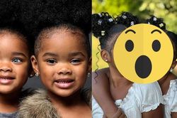 Nổi tiếng nhờ đôi mắt hiếm chưa từng thấy, cặp song sinh đình đám bây giờ ra sao?