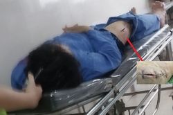 Một cán bộ Cục Thuế Ninh Bình bị kẻ bịt mặt đâm thương tích