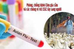 Bé gái nhiễm cúm A/H5: Tình trạng sức khỏe nguy kịch, gia đình từng mổ, ăn gia cầm ốm