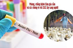 5 biện pháp phòng bệnh cúm lây từ gia cầm sang người