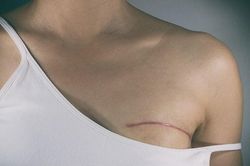 Thực phẩm tốt nhất giúp ngăn ngừa ung thư vú