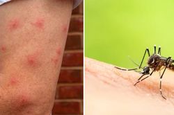 Cảnh báo dịch sốt xuất huyết ở Hà Nội tăng mạnh