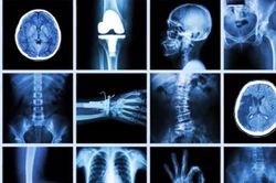 Sự thật đau lòng sau thí nghiệm tạo ra tia X-quang đầu tiên TG