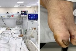 Giẫm phải cọc trâu, người đàn ông suýt mất mạng