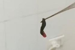 Xử lý thành công con vắt dài hơn 2 cm trong hốc mũi bệnh nhân