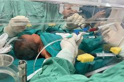 Bé 3 ngày tuổi bất đồng nhóm máu với mẹ, phải thay máu hoàn toàn