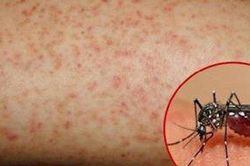 Thảo dược hỗ trợ trị sốt xuất huyết giai đoạn mới phát