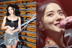 Tình trạng sức khỏe đáng báo động của Jisoo (BlackPink)