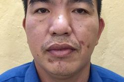 Mạo danh là Công an, lừa nhận tiền của gia đình bệnh nhân 'chạy' mổ sớm
