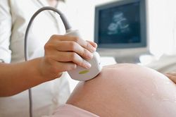 Mất con vì chủ quan không đi khám thai định kỳ