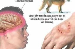 Nghệ An: Xử nghiêm cơ sở, cá nhân tuyên truyền sử dụng thuốc Nam để điều trị bệnh dại