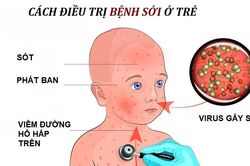 Chú ý bảo vệ sức khỏe trẻ em khi giao mùa