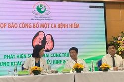 Hà Nội: Ca song thai cùng trứng cực kỳ đặc biệt, thế giới mới ghi nhận 1 trường hợp