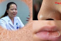Tư vấn bác sĩ: Những cách chăm sóc da vào mùa đông