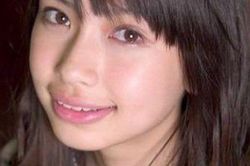 Angelababy kiện bệnh viện vì 36 bức ảnh thời chưa chỉnh răng