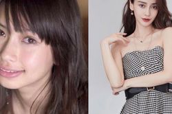 Lấy hình ảnh chưa chỉnh răng của Angela Baby tuyên truyền, một bệnh viện bị kiện