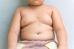 Vì sao trẻ thừa cân béo phì dễ dậy thì sớm?