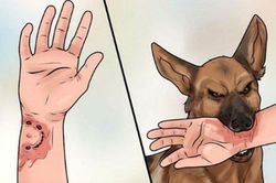 Tử vong sau 2 tháng bị chó hoang cắn