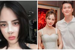 MC Bạch Lan Phương - bạn gái Huỳnh Anh can thiệp 'dao kéo'