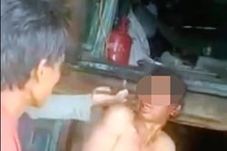 Khởi tố vụ án hai người đàn ông bị đánh đập, hành hạ dã man trên tàu cá
