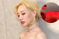 Hari Won tiết lộ tình trạng sức khỏe hiện tại, phải đi châm cứu mỗi ngày