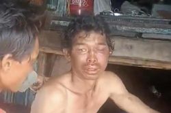 Vụ ngư dân bị hành hạ trên tàu: Thương tích 48%, khởi tố bị can, bắt giam 3 đối tượng