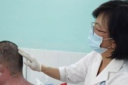 Thêm nhiều trường hợp nhập viện do sử dụng thuốc chữa vảy nến trên mạng