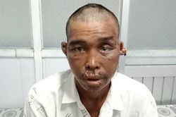 Vụ người đàn ông bị hành hạ: Thêm tội cố ý gây thương tích hay không