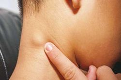 Cơ thể có 3 tín hiệu lạ ở cổ chứng tỏ K gõ cửa, nhiều người biết mà làm ngơ