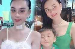 Lâm Khánh Chi chi tiền tỷ trùng tu trẻ hóa