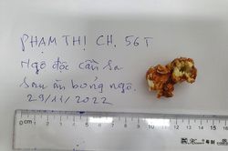 Ngộ độc cần sa sau khi ăn bỏng ngô mua trên mạng
