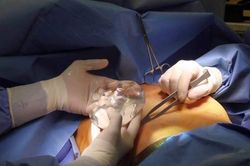 TP.HCM: Cô gái 25 tuổi chết sau khi phẫu thuật thẩm mỹ tại KeyBeauty Center