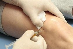 Có nên tiêm steroid trị viêm khớp gối?
