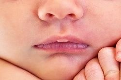 Phòng bệnh về da ở trẻ vào mùa đông