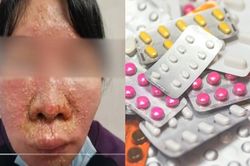 Bệnh nhân pha lẫn 7 loại thuốc để uống, bác sĩ hết hồn